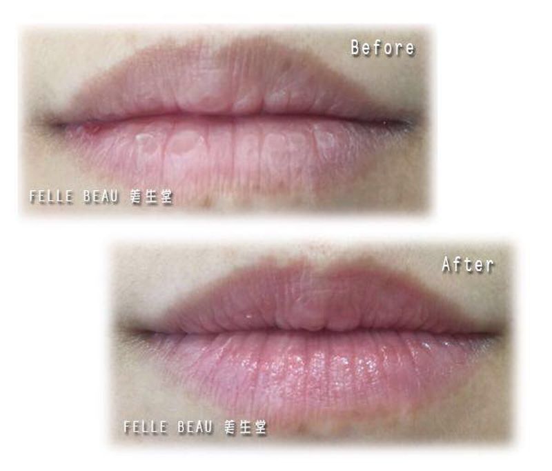 Korean Style Lip